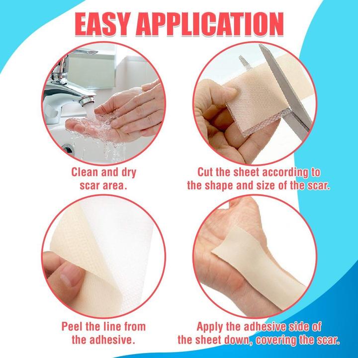 Korean Scar Remover Silicon Gel Patch [Authentic]