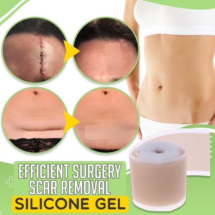 Korean Scar Remover Silicon Gel Patch [Authentic]