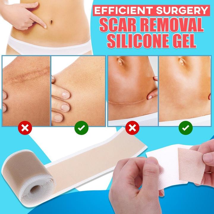 Korean Scar Remover Silicon Gel Patch [Authentic]