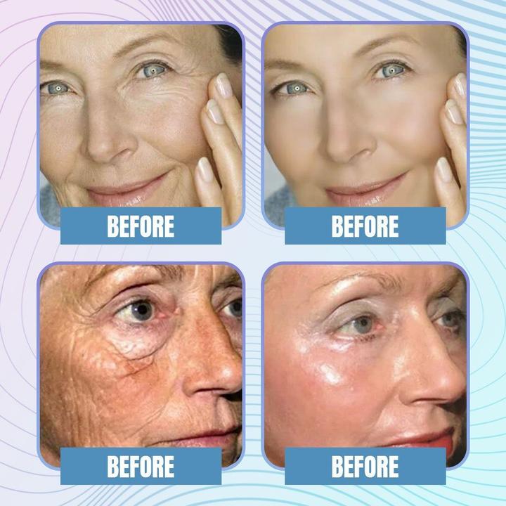 Korean Face lifting Patch [ Anti Wrinkle & Aging ]